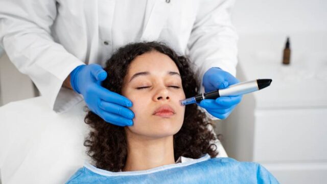 میکرونیدلینگ پوست چیست و چگونه انجام میشود؟