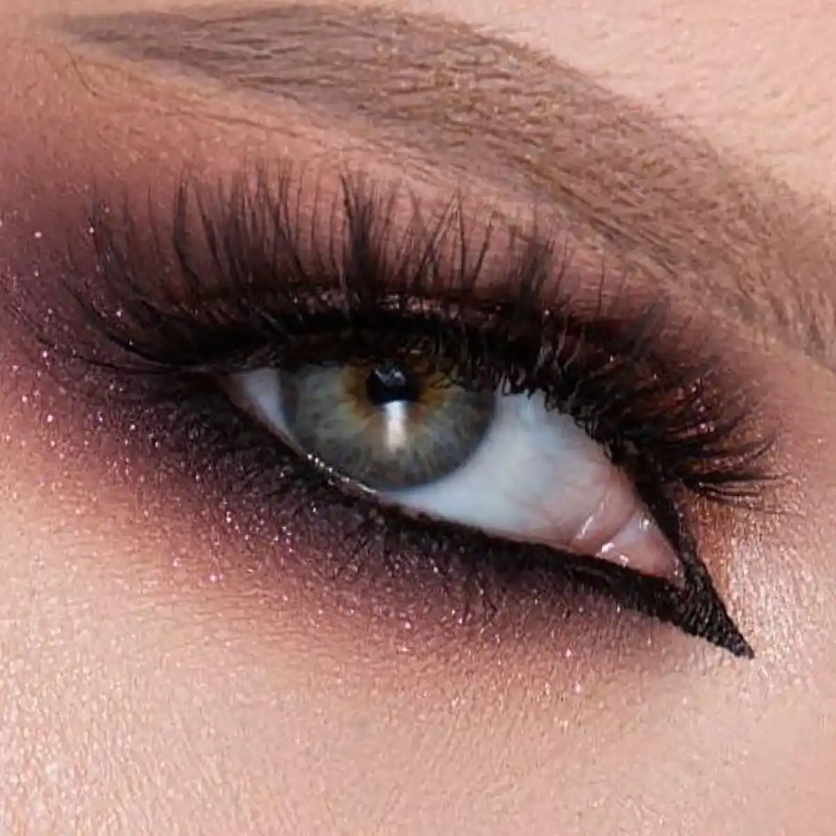 سایه چشم اکلیلی