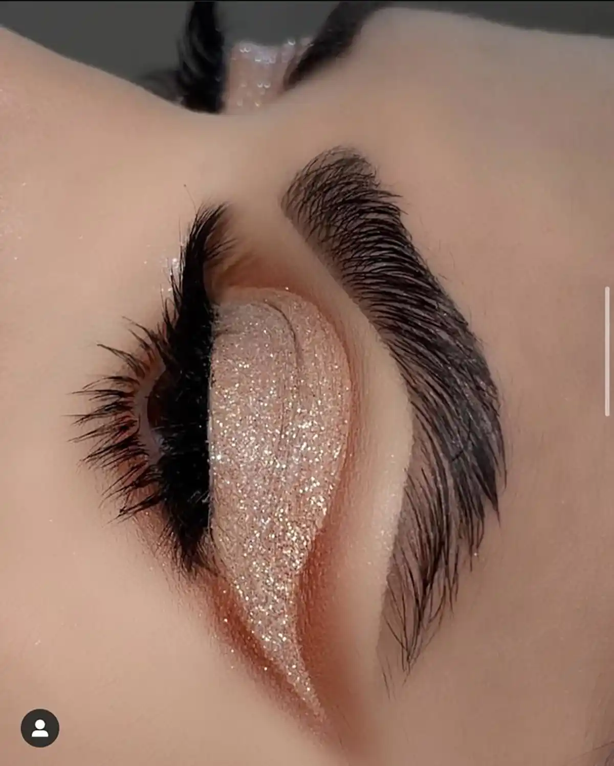 سایه چشم شاین 