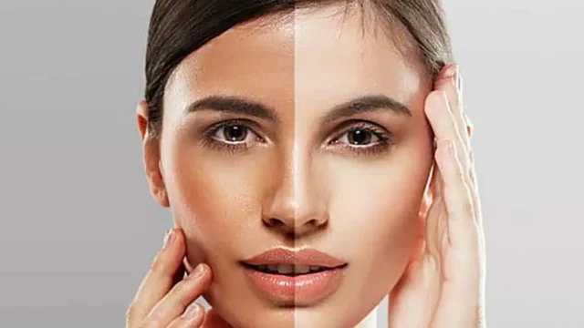 بهترین روش برای روشن شدن پوست صورت | از راه‌کار خانگی تا دارو