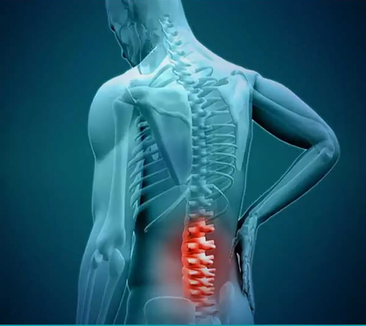 بهترین ورزش برای دیسک کمر و سیاتیک فیلم ورزش برای دیسک کمر درمان معجزه اسای دیسک کمر با ورزش فیلم ورزش برای سیاتیک و دیسک کمر درمان معجزه فیلم ورزش دیسک کمر ایا با ورزش دیسک کمر خوب میشود فیلم ورزش دیسک کمر مهره 4و5 فیلم ورزش برای بیرون زدگی دیسک کمر