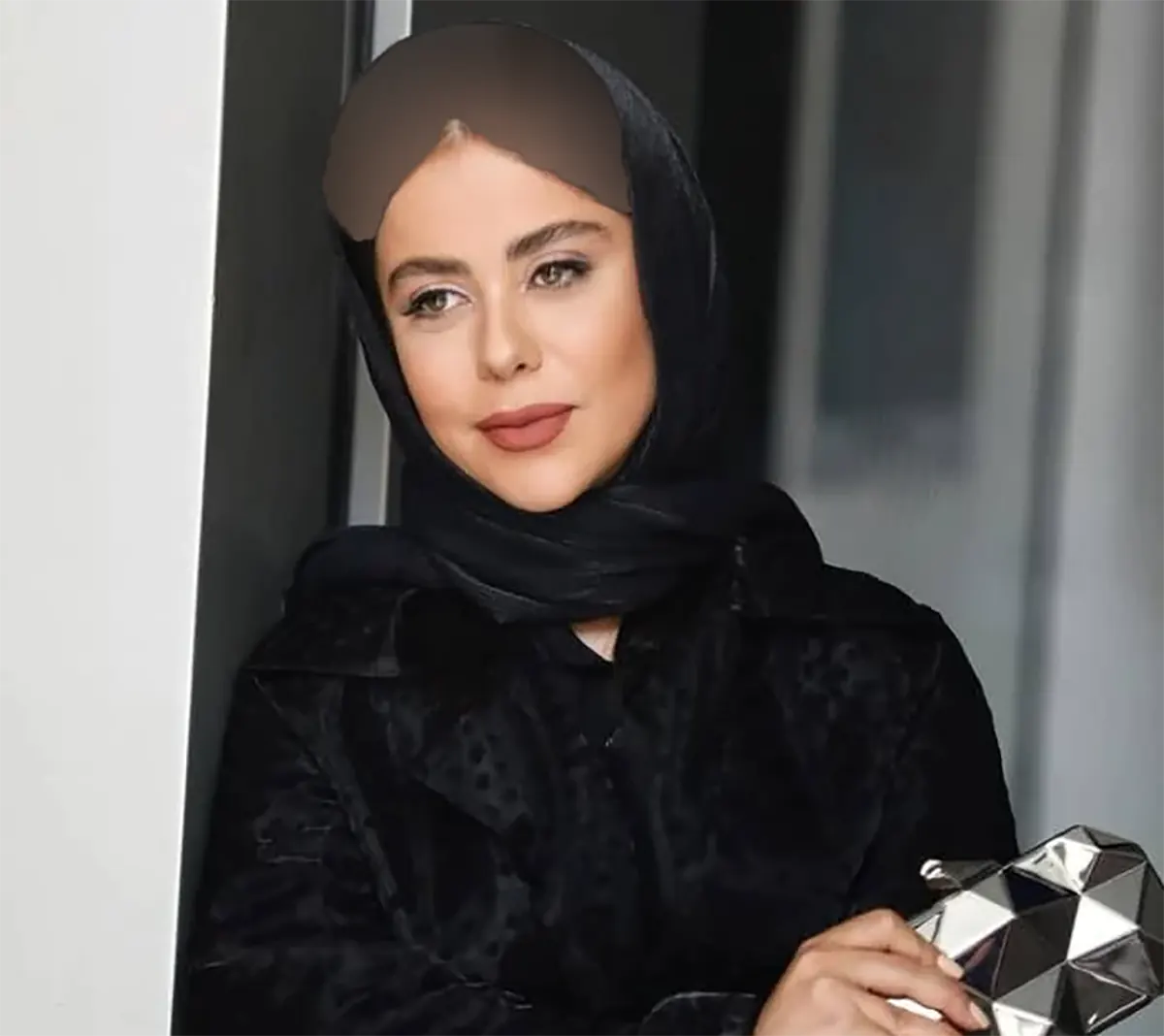 الهام اخوان قبل از عمل