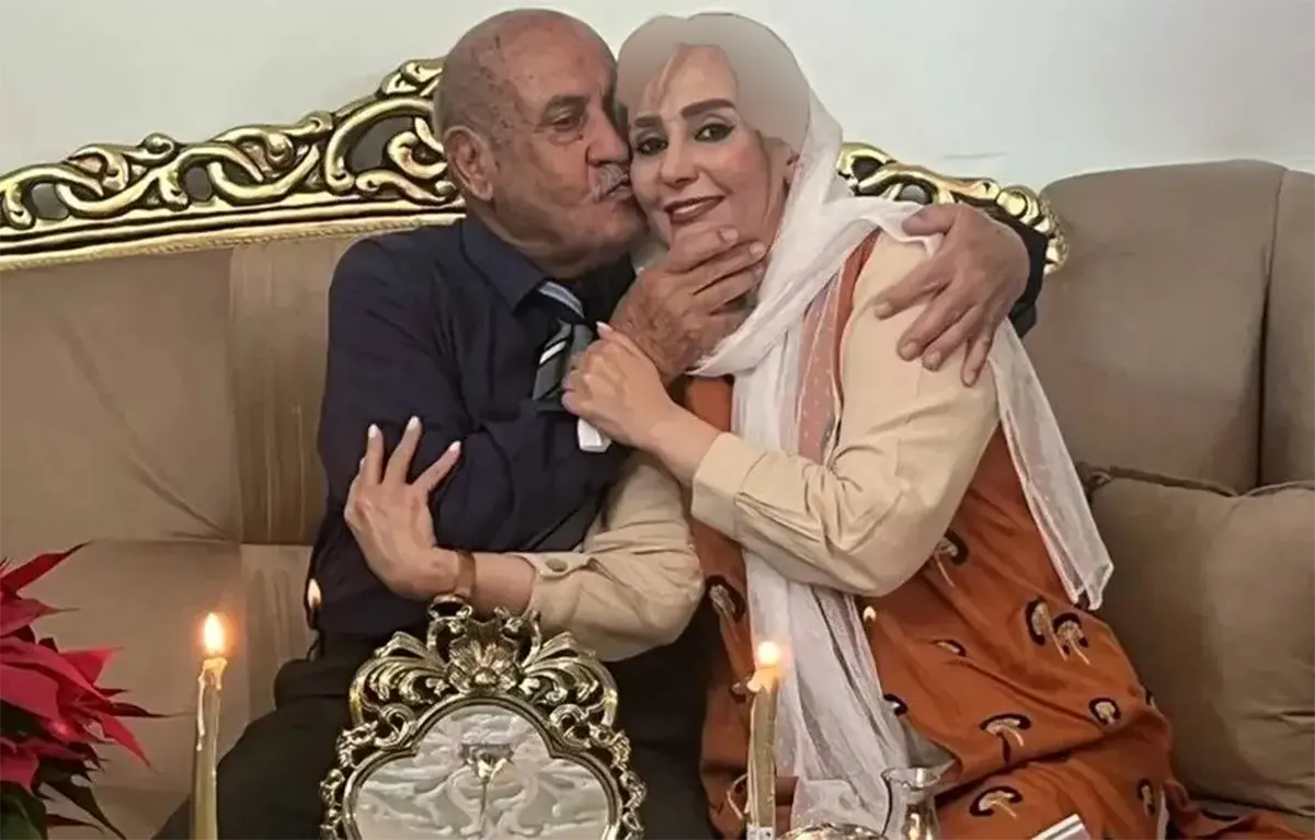 شیوا خسرومهر قبل و بعد از عمل